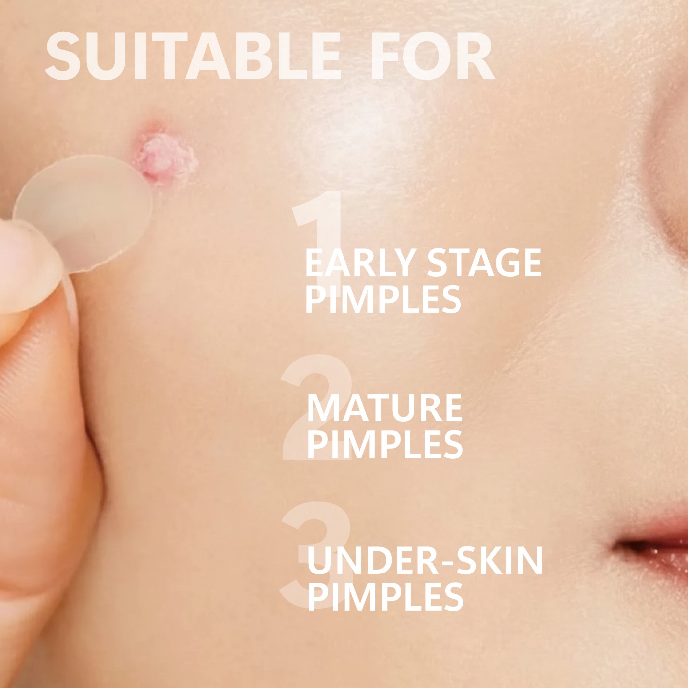 Patch anti-acné à micro-aiguil - Face Moisturizer avis et prix