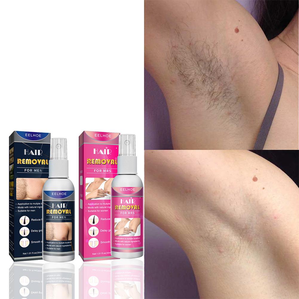 Épilateur Permanent indolore S - Body Lotion avis et prix